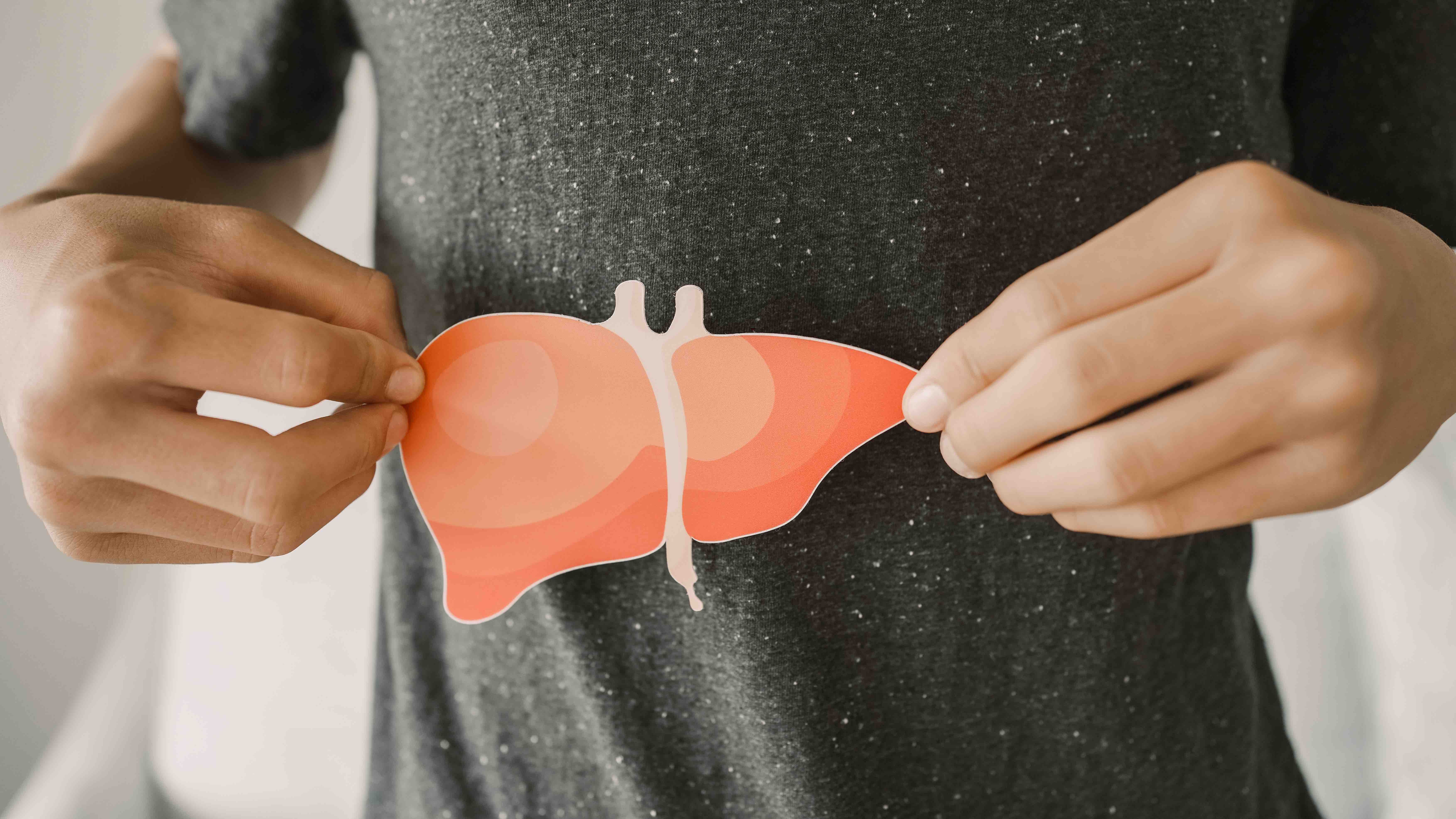 MASLD significantly increases the risk of severe infection, a literature review suggests. | Image credit: SewcreamStudio - stock.adobe.com