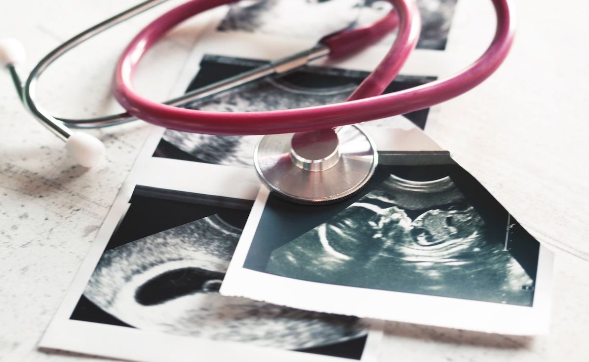 Ultrasound and a stethoscope | Image Credit: © Natalya Lys-stock.adobe.com