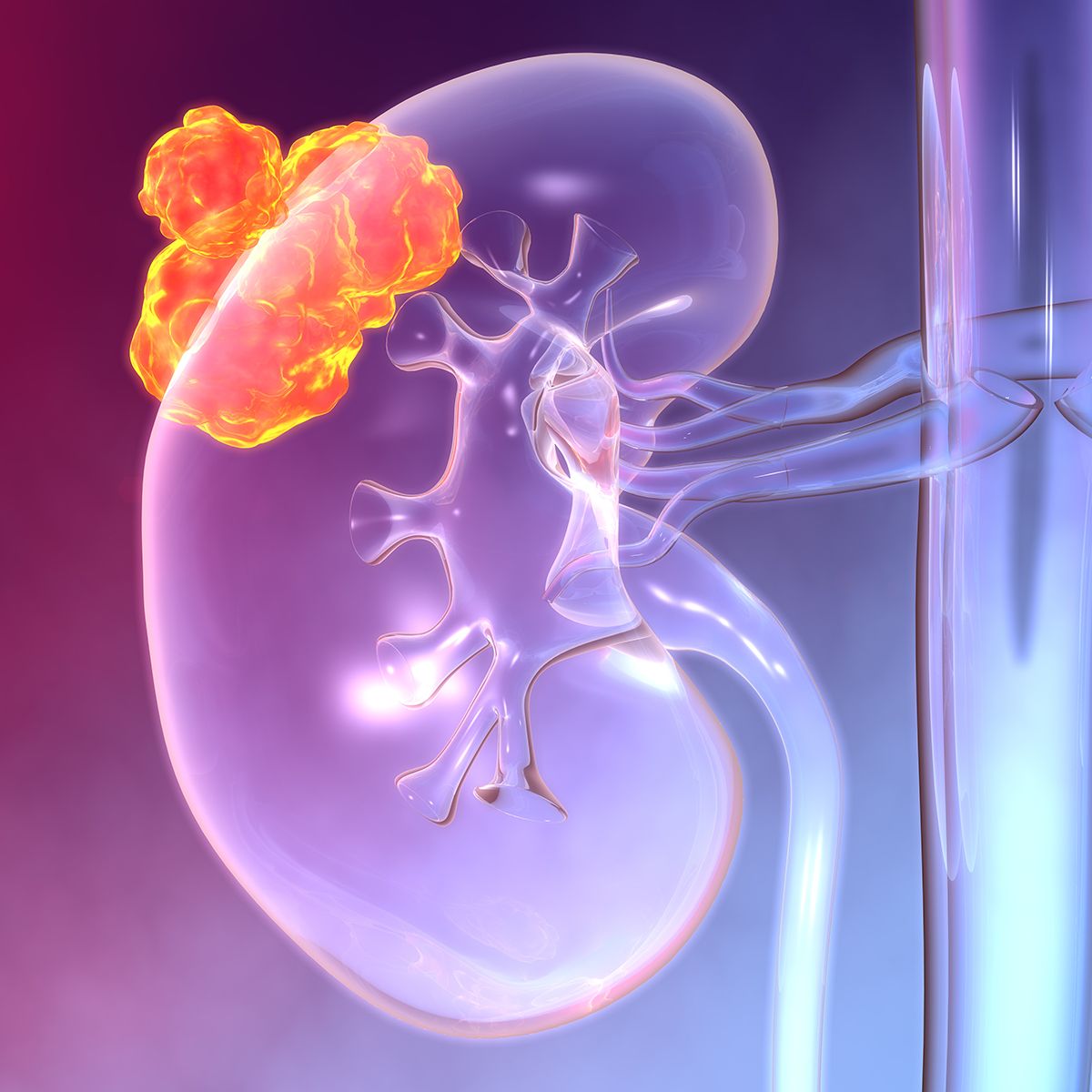 March is Kidney Cancer Awareness Month, and voices like Sid Sadler are raising awareness: © Axel Kock - stock.adobe.com