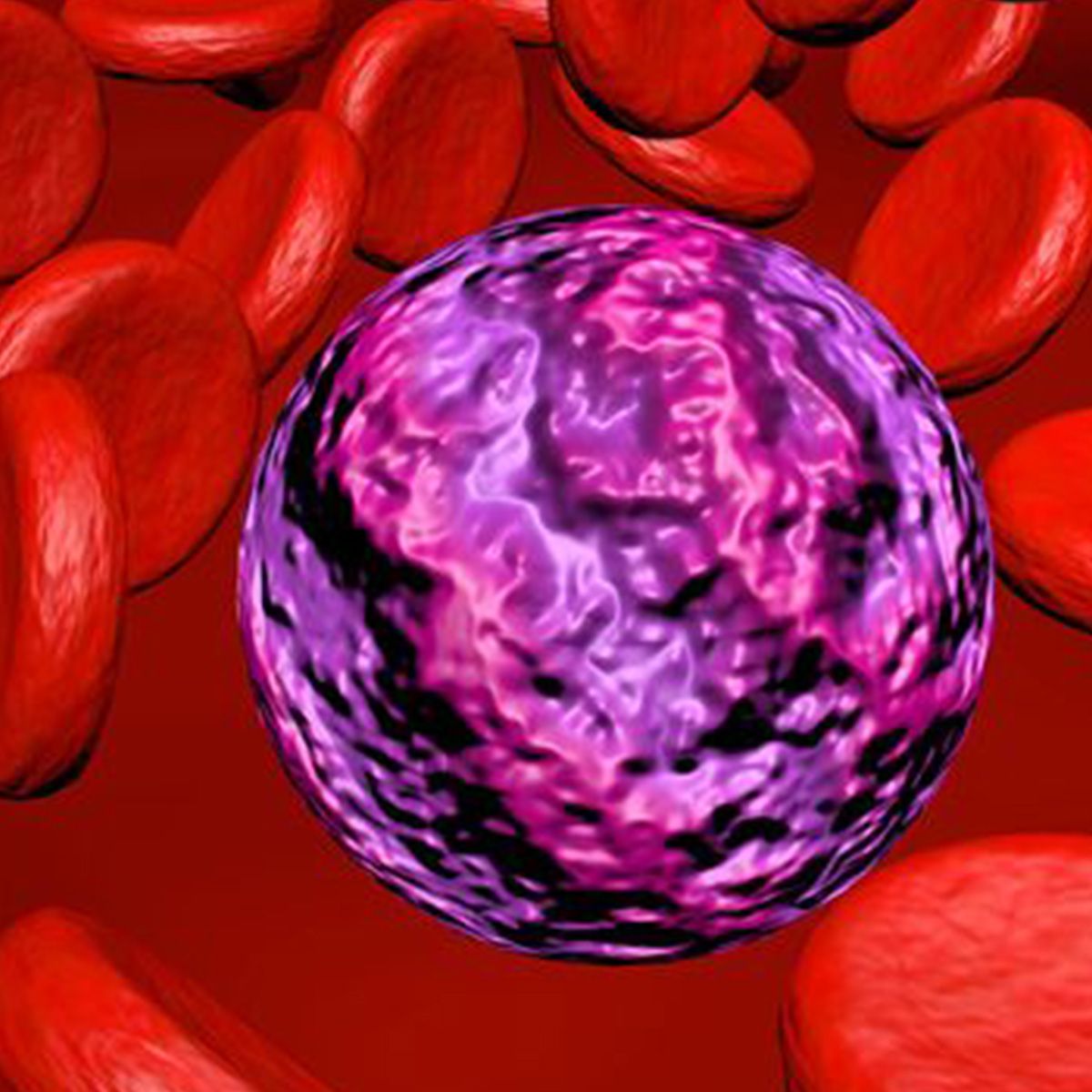 Graphic of red blood cells with a leukemia cell