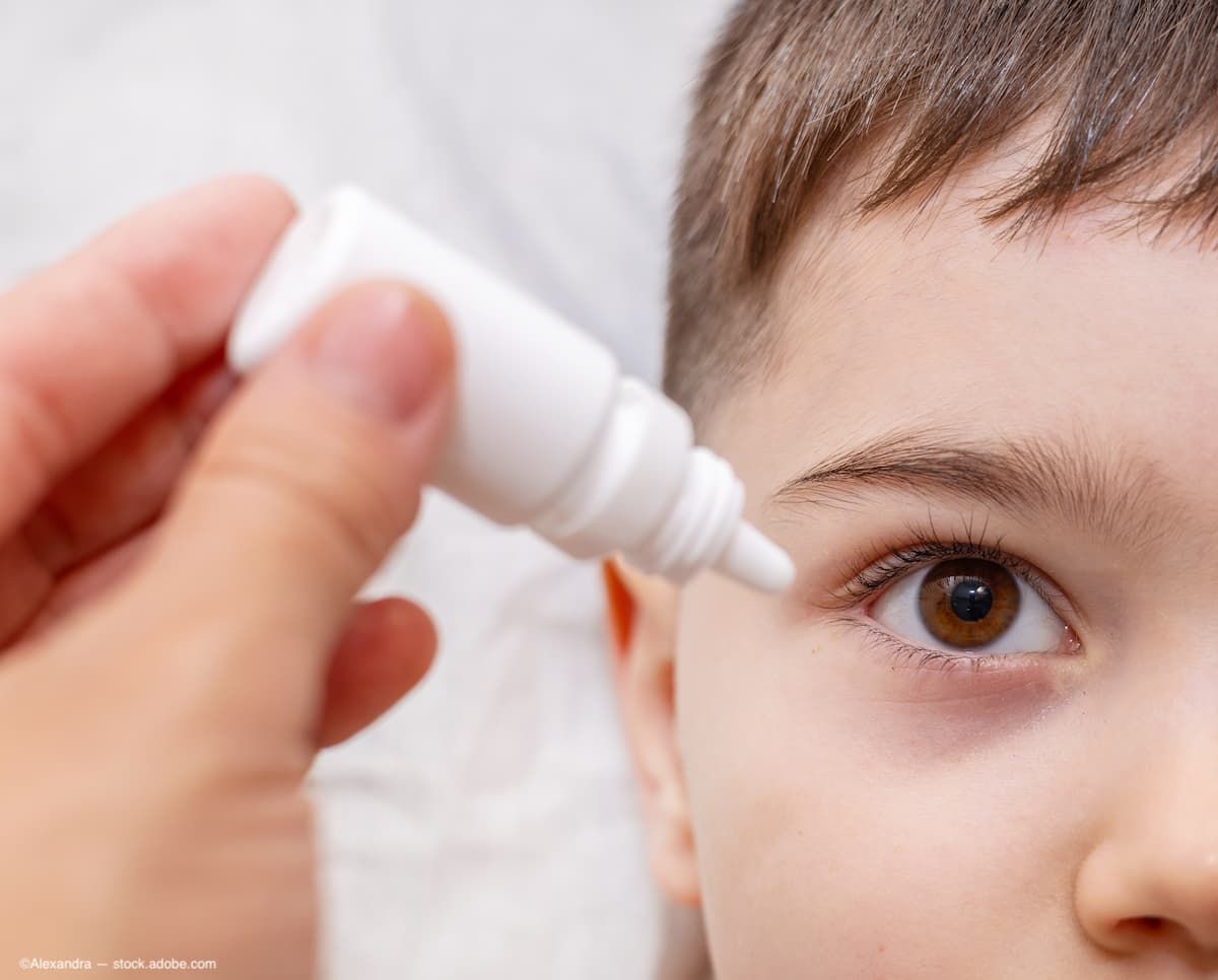 iVeena submits IND to FDA for phase 2 clinical trial for pediatric myopia