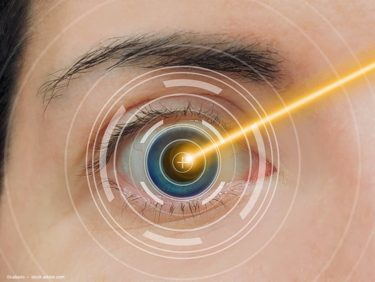 Initial impressions with pattern laser indirect ophthalmoscope in first 10 patients